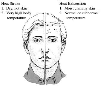 Heat Stroke vs. Heat Exhaustion