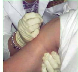 Photo of a person receiving a dose of rabies vaccine