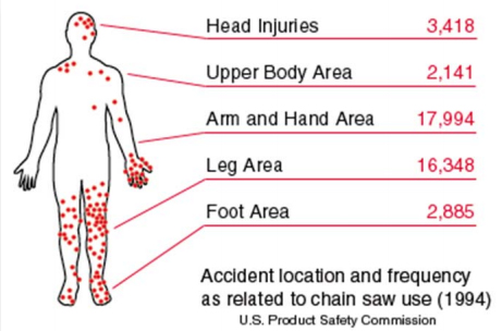 Drawing of accident location and frequency as related to chain saw use on the human body from 1994. Head Injuries,  shoulders, left arm and hand, legs and feet being the most common.