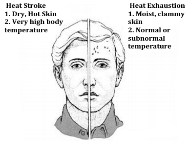 Picture presenting Heat Stroke symptoms: Dry, hot skin and very high temperature, and Heat Exhaustion symptoms: Moist clammy skin and normal or subnormal temperature.