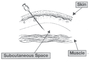 graphic showing a subcutaneous injection