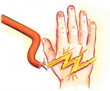 wire hand warning