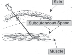 Diagram of an intramuscular injection