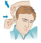 Graphic of Pulling ear back and inserting an earplug