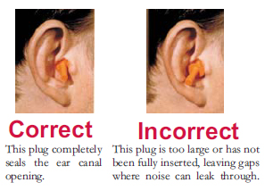 fitted vs. unfitted earplugs